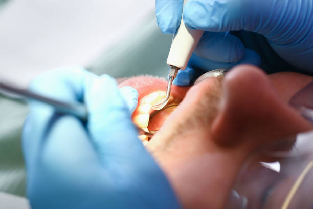 Best Pediatric Emergency Dentist in Franklin Grove, IL